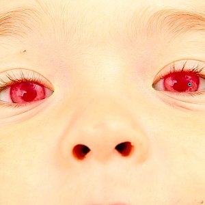 aptimize an eye with Lightroom 4